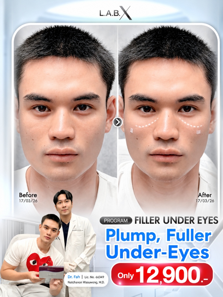Under-Eyes Dermal Filler Promotion by Dr. Fah - 12,900 THB